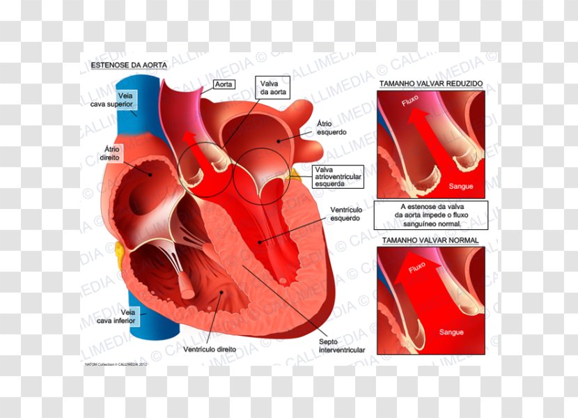 Mitral Valve Stenosis Insufficiency Aorta Aortic - Frame - Heart Transparent PNG