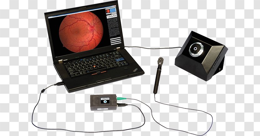 Ophthalmoscopy Simulation Virtual Reality Simulator Virtuality - Multimedia Transparent PNG