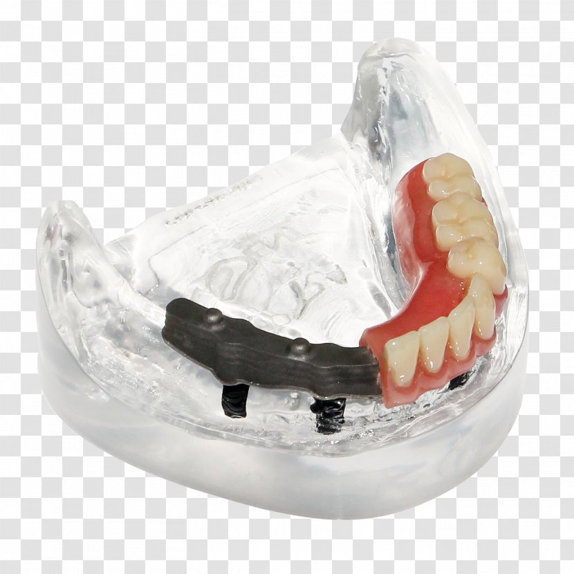 Dentures Tooth Made, Netherlands Digital Data .be - Jaw - Braces With Partial Transparent PNG