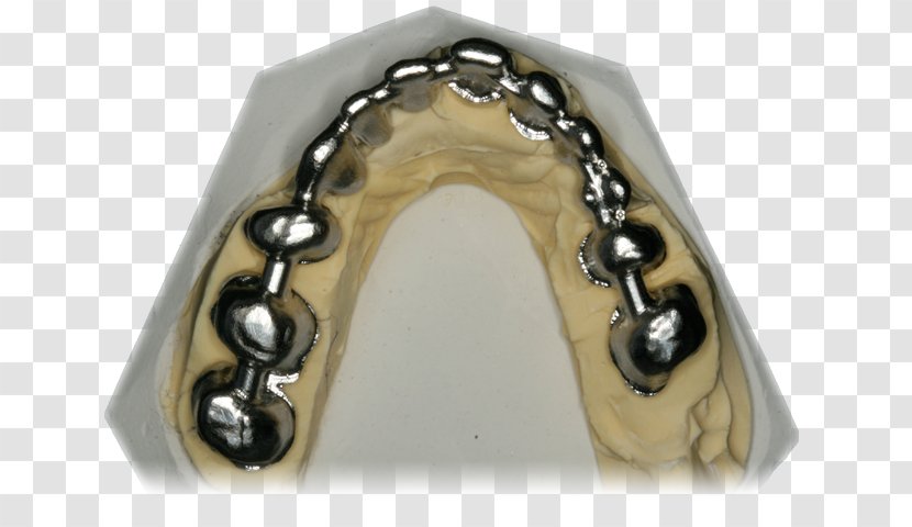 Metal Body Jewellery - Dental Bridge Transparent PNG