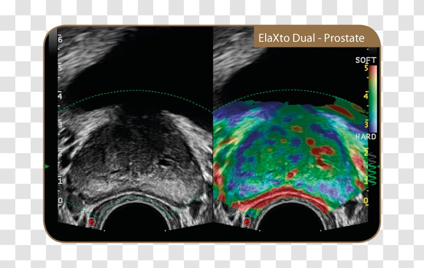 Ultrasonography Medicine Bmt Medtekhnika Medical Equipment Magnetic Resonance Imaging - De - Advanced Technology Transparent PNG