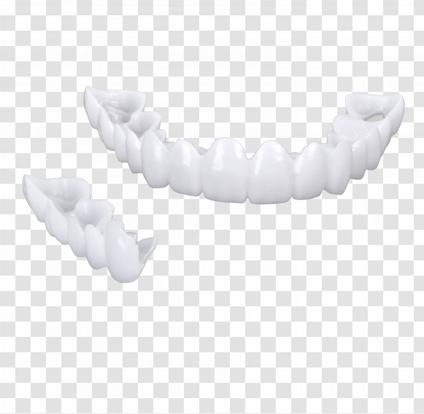 Veneer Dentures Tooth Whitening Dentistry - Pathology - Teepee Transparent PNG
