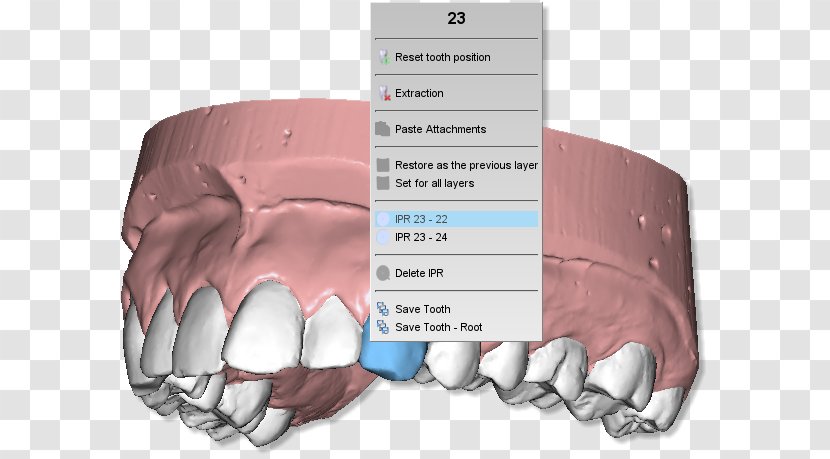 Tooth Clipboard Product Manuals Dentistry Computer Software - Tree - Dental Teeth Model Transparent PNG