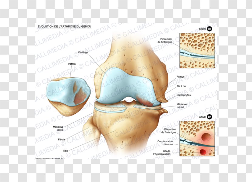 Bone Fracture Knee Disease Joint Tibia - Muscular Development Transparent PNG