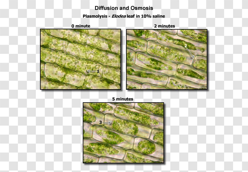 Plasmolysis Plant Cell Elodea Biology - Body Muscle Anatomy Therapy Transparent PNG