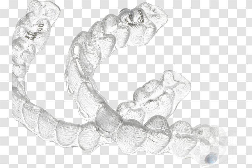 Clear Aligners Orthodontics Dentistry Dental Braces Sunnyvale Aesthetics - Patient - Health Transparent PNG