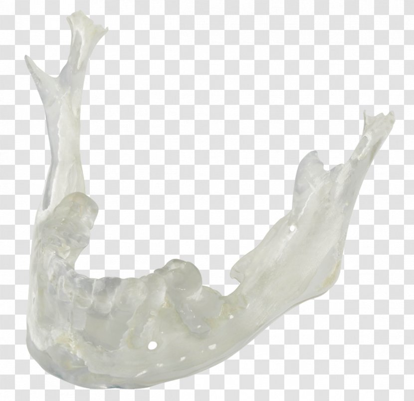 Dental Crafters, Inc. 3D Printing Laboratory Implant Transparent PNG