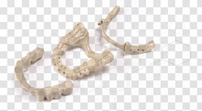 Material Dentures Computer-aided Design CAD/CAM Dentistry Inlays And Onlays - Body Jewelry - Dental Transparent PNG