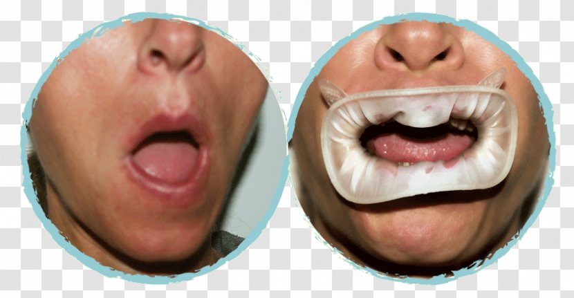 Nose Chin Cheek Jaw Mouth - Workout Exercises Transparent PNG