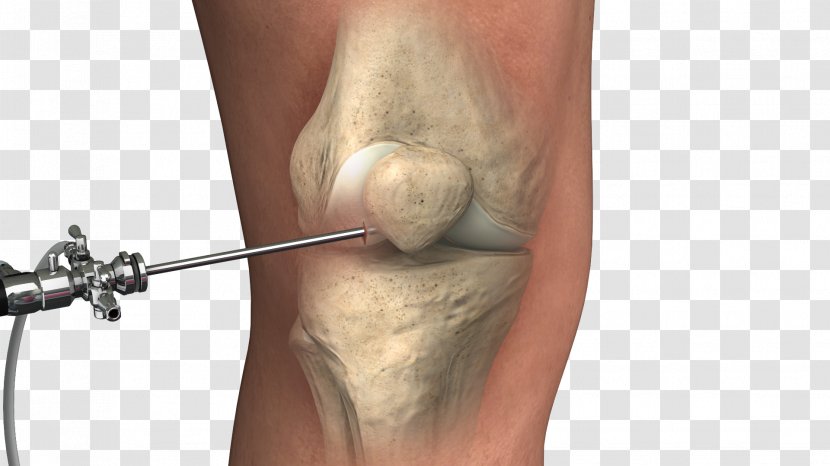 Orthopedic Surgery Knee Lipogems International SpA Therapy - Orthopaedic Transparent PNG
