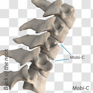 The Cervical Disc Surgery Anterior Discectomy And Fusion Vertebrae Intervertebral Arthroplasty - Organism - Neck Transparent PNG