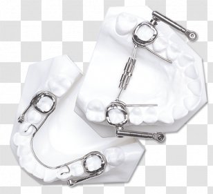 Orthodontics The Herbst Appliance Orthodontic Technology Tooth Mandible - Metal Transparent PNG