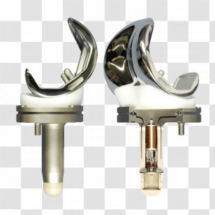 Knee Replacement Joint Arthroplasty Osteoarthritis Transparent PNG