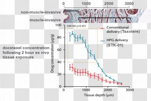 Urinary Bladder Cancer Therapy Sitka Biopharma Inc. - Clinical Trial Transparent PNG
