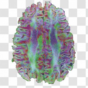 Brain Purple Medicine Transparent PNG