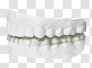 Temporomandibular Joint Dysfunction Splint Dentist Orthodontics - White - Bruxism Transparent PNG