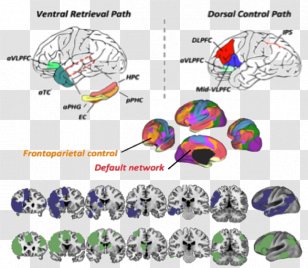 Ventrolateral Prefrontal Cortex Cognition Functional Magnetic Resonance Imaging Brain - Tree Transparent PNG