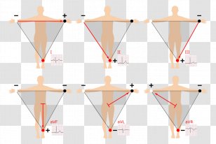 3-Lead EKG Electrocardiography Introduction To 12-Lead ECG: The Art Of ...