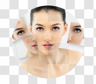 Personal Care Acne Facial Exfoliation Skin - Scar - Face Transparent PNG