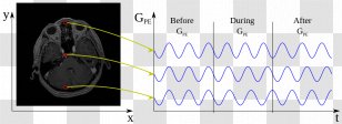Physics Of Magnetic Resonance Imaging Wikimedia Commons Phase Angle - Tree Transparent PNG