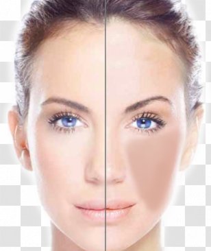 Freckle Laser Hair Removal Intense Pulsed Light - Beauty - London Eye Transparent PNG