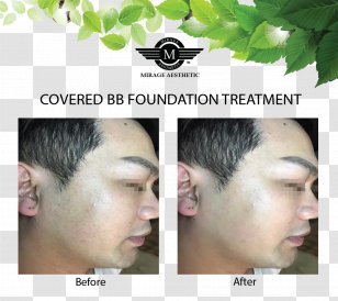 Laser Surgery Therapy Face Scar - Human Tooth Transparent PNG