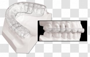 Mandibular Advancement Splint Dentistry Jaw Temporomandibular Joint Dysfunction - Orthodontics Transparent PNG