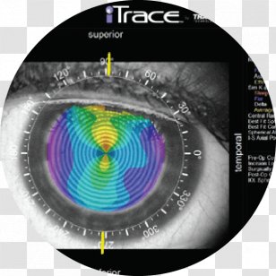 Ophthalmology Eye Examination Astigmatism Far-sightedness - Lasik Transparent PNG