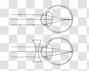 Near-sightedness Eye Far-sightedness Visual Perception Floater - Cartoon Transparent PNG
